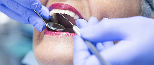 Best Emergency Dentist for Knocked-Out Tooth in Boardman, OR