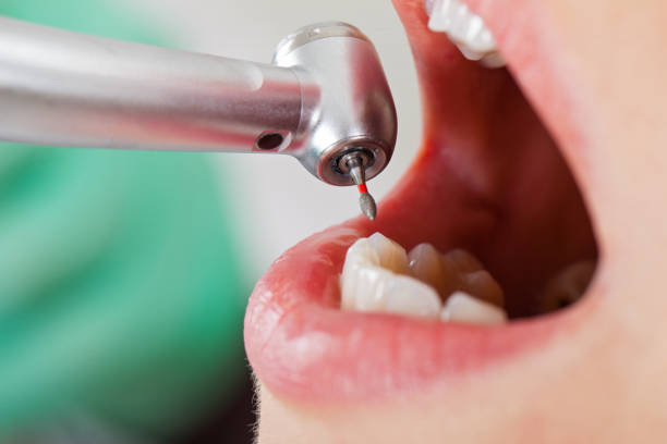 Best Pediatric Emergency Dentist in Boardman, OR